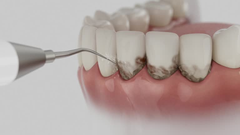 Reliable Dental Implants contractor in Salina, KS by Smile Center Dentistry